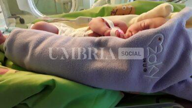 Eseguita all’Ospedale di Perugia una TAC all'aorta su un neonato di appena 2 giorni per una rarissima malformazione 9 WhatsApp Image 2024 01 23 at 15.00.31