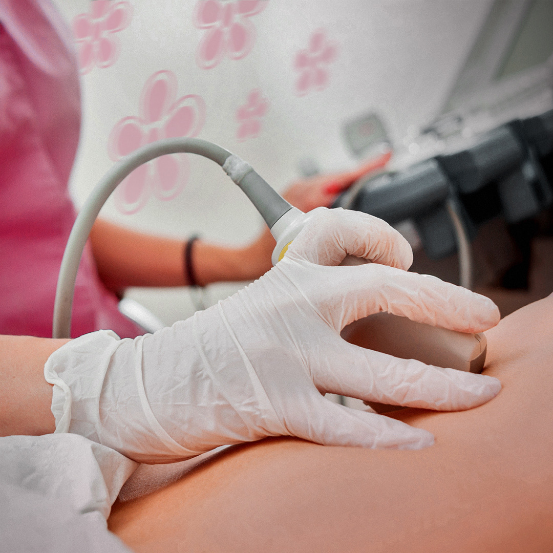 Foligno, A.P.E. in ospedale per informare sull’endometriosi 18 Foligno, A.P.E. in ospedale per informare sull’endometriosi 17